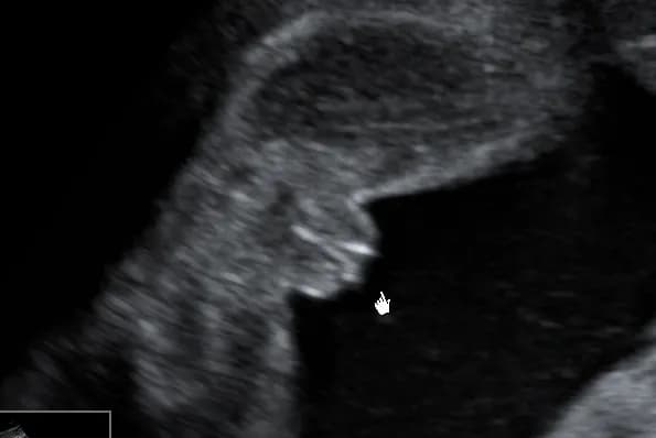 Kiedy w ciąży można poznać płeć dziecka? Oto najważniejsze informacje