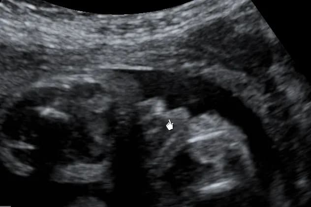 Płeć dziecka kiedy widać? Sprawdź najwcześniejsze metody i dokładność